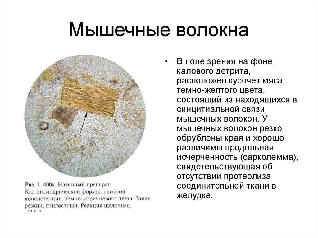 Нарушения стула у новорожденных