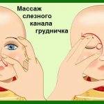 Массаж слезного канала у новорожденных: как делать при закупорке и непроходимости
