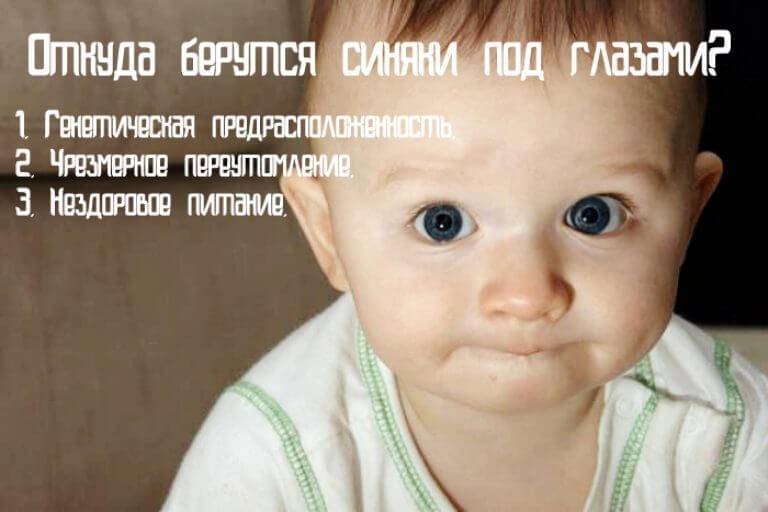 Отеки под глазами у ребенка: причины припухлости нижнего века у грудничка до года и после, лечение, профилактика