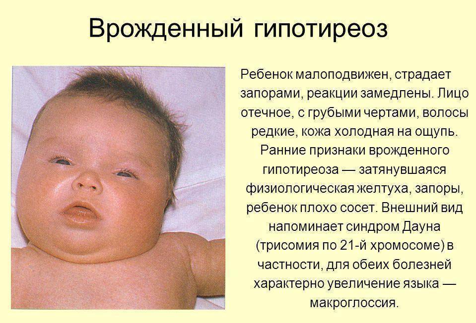 Развитие зрения у новорожденных детей: особенности, что важно знать