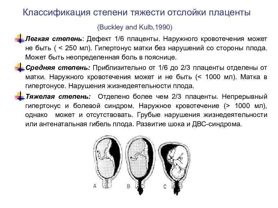Отслойка плаценты | симптомы | диагностика | лечение - docdoc.ru