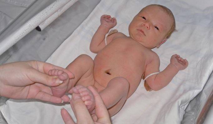 Бледность и цианотичность кожных покровов у ребенка: причины, проявления, диагностика