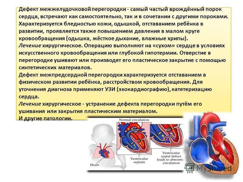 Дефект межжелудочковой перегородки у новорожденного: операция на сердце при впс - мышечном дмжп