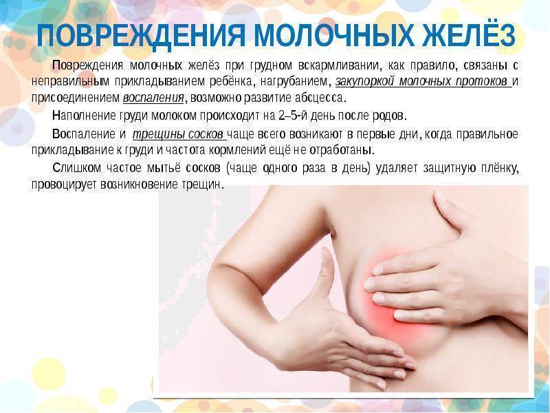 Мастит новорожденных: набухание молочных желез у грудных девочек и мальчиков