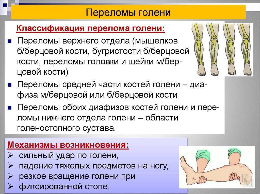 Переломы костей у детей - симптомы болезни, профилактика и лечение перелома костей у детей, причины заболевания и его диагностика на eurolab