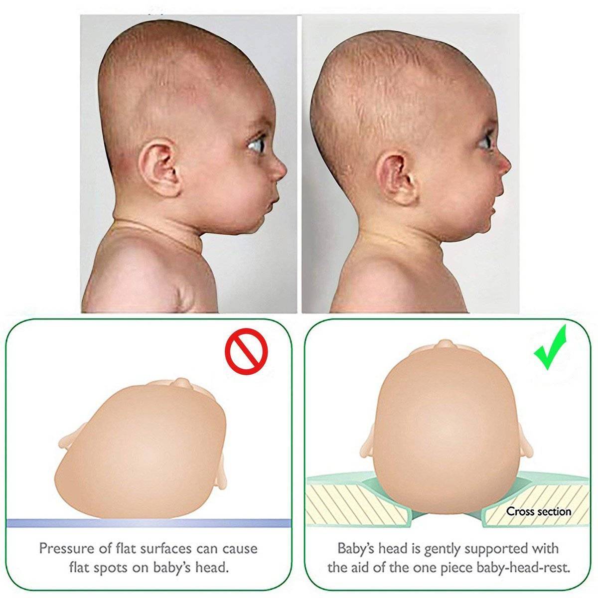 Почему голова вытянутая. Форма головы новорожденного. Правильная форма головы у грудничка.