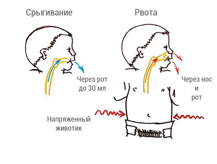 Рвота у грудничка после кормления грудным молоком, что делать?