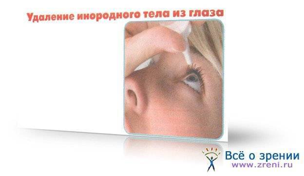 Как быстро вытащить ресницу из глаза, не повредив слизистую – 6 эффективных способов