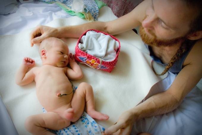 Водянка яичек: особенности и лечение у новорожденных мальчиков