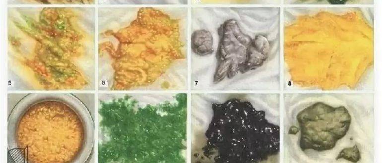 Сколько какает месячный ребенок и сколько раз он должен какать?