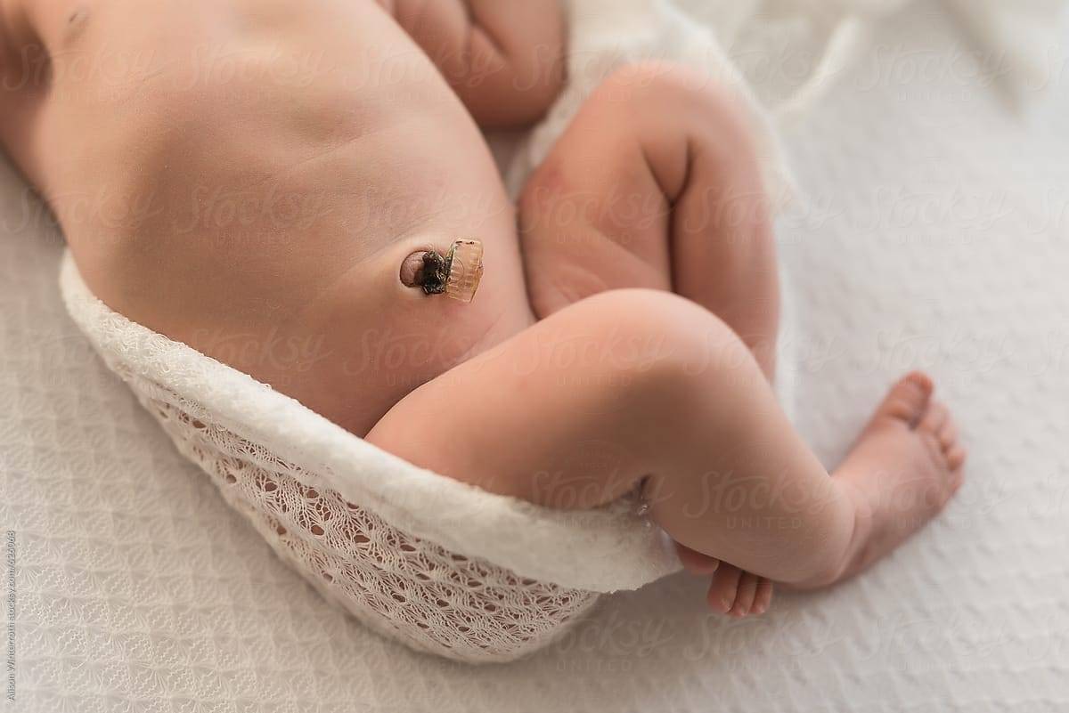 Как правильно обрабатывать пупок у новорожденного, обработка пупочного остатка под прищепкой и вокруг нее