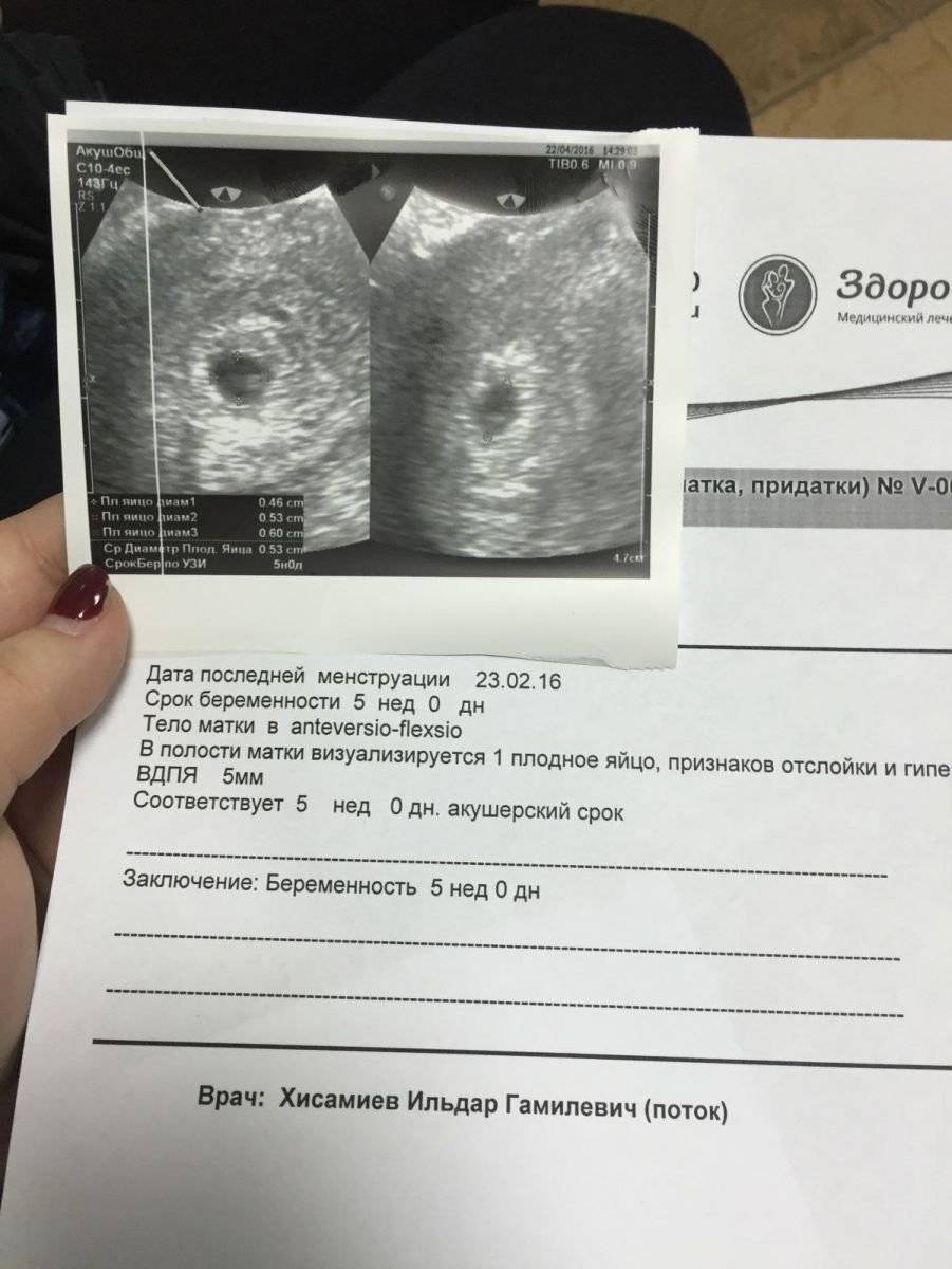 Узи на 5 неделе беременности: фото, что покажет, размеры плода