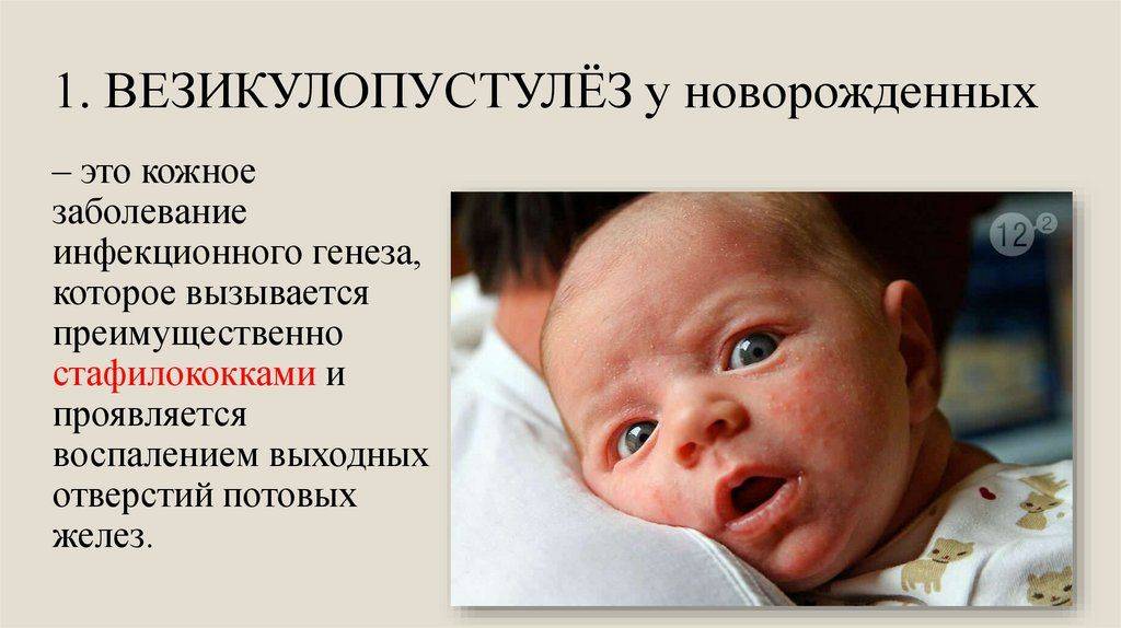 Золотистый стафилококк у грудничка - симптомы и лечение