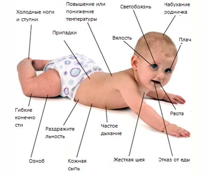 Как проявляется менингит у детей