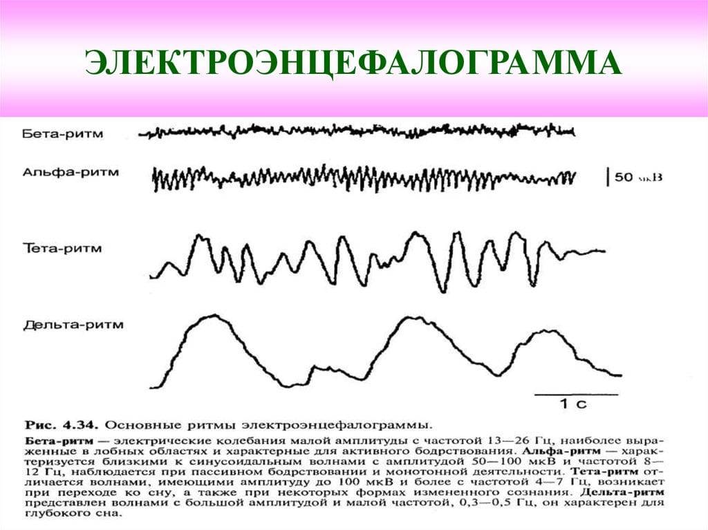 Как проводят ээг детям?