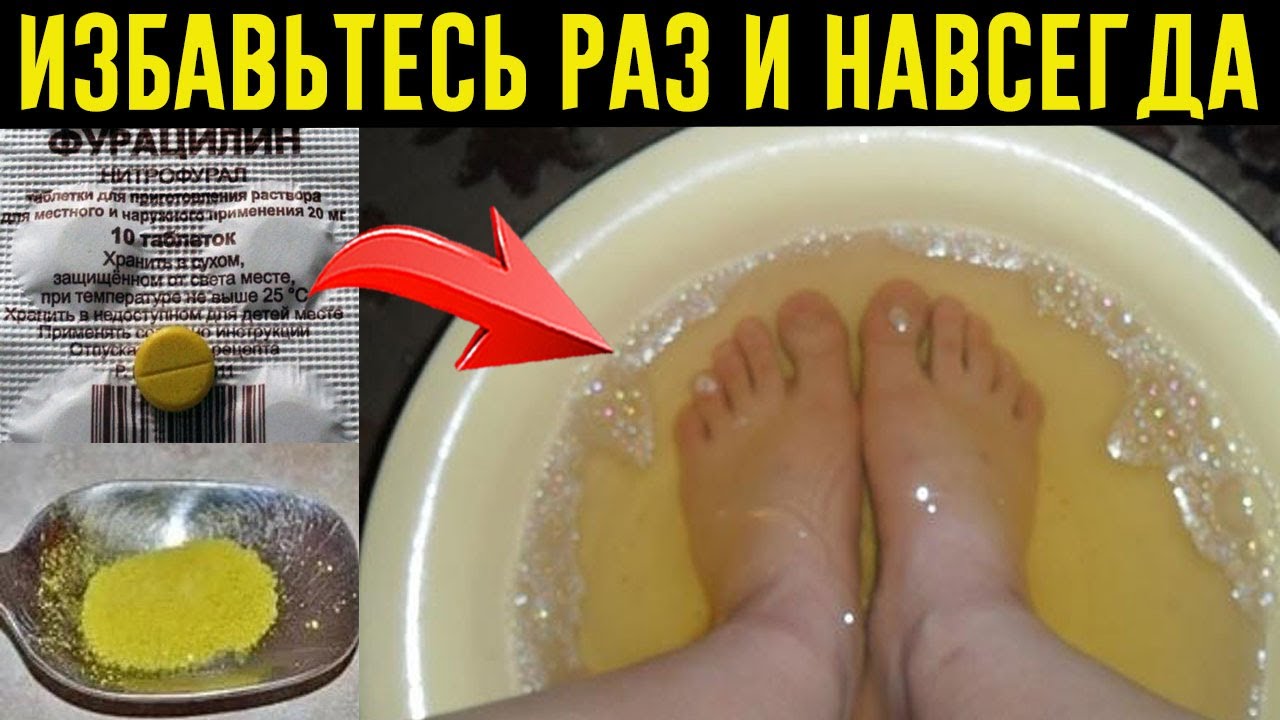 Лучшие народные средства от потливости ног: рецепты, советы и рекомендации | нет потливости