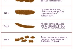 Нарушения стула у новорожденных
