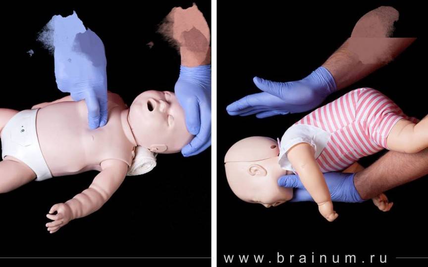 Что делать, если ребёнок подавился и задыхается: первая помощь новорождённому +видео