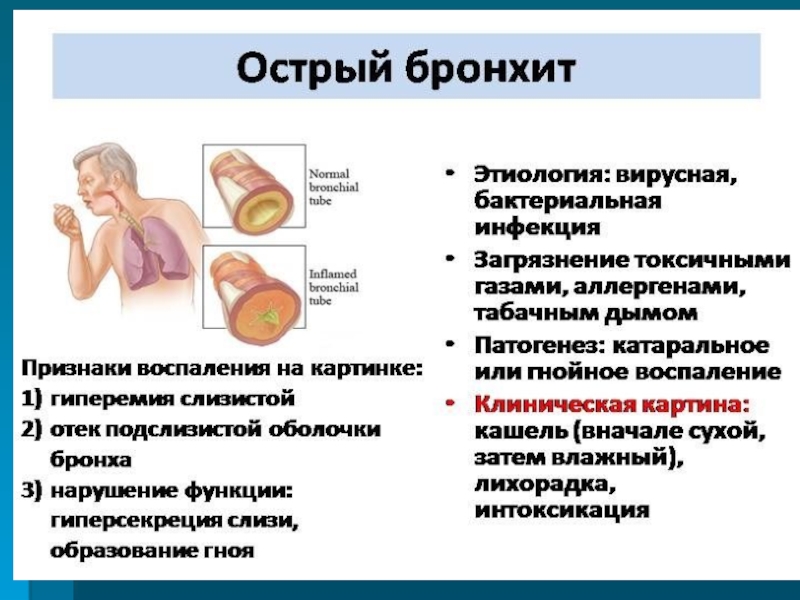 Бронхит у грудничка: признаки, симптомы и лечение