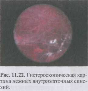 Вульвит и вульвовагинит у девочек: симптомы и лечение в пятигорске