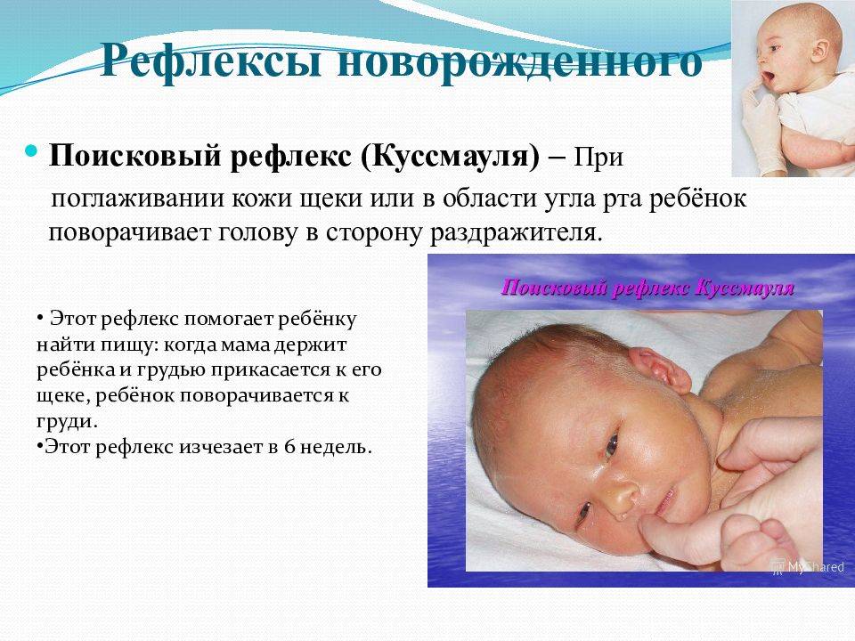 Рефлексы новорожденных    | материнство - беременность, роды, питание, воспитание