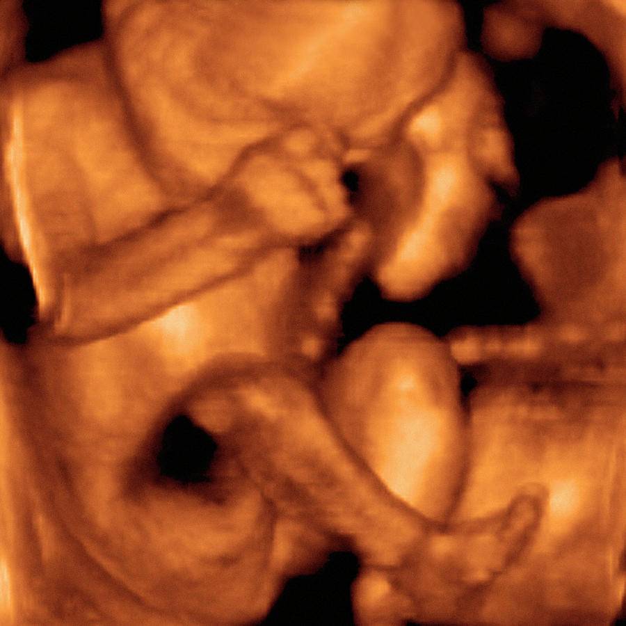 35 неделя беременности: что происходит с малышом и мамой, вес, рост и развитие плода, ощущения, подготовка к родам