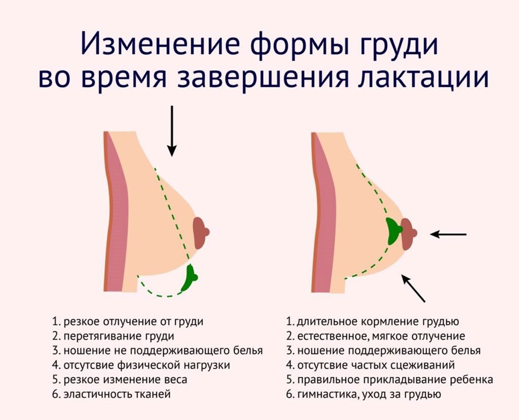 Как восстановить грудь после родов