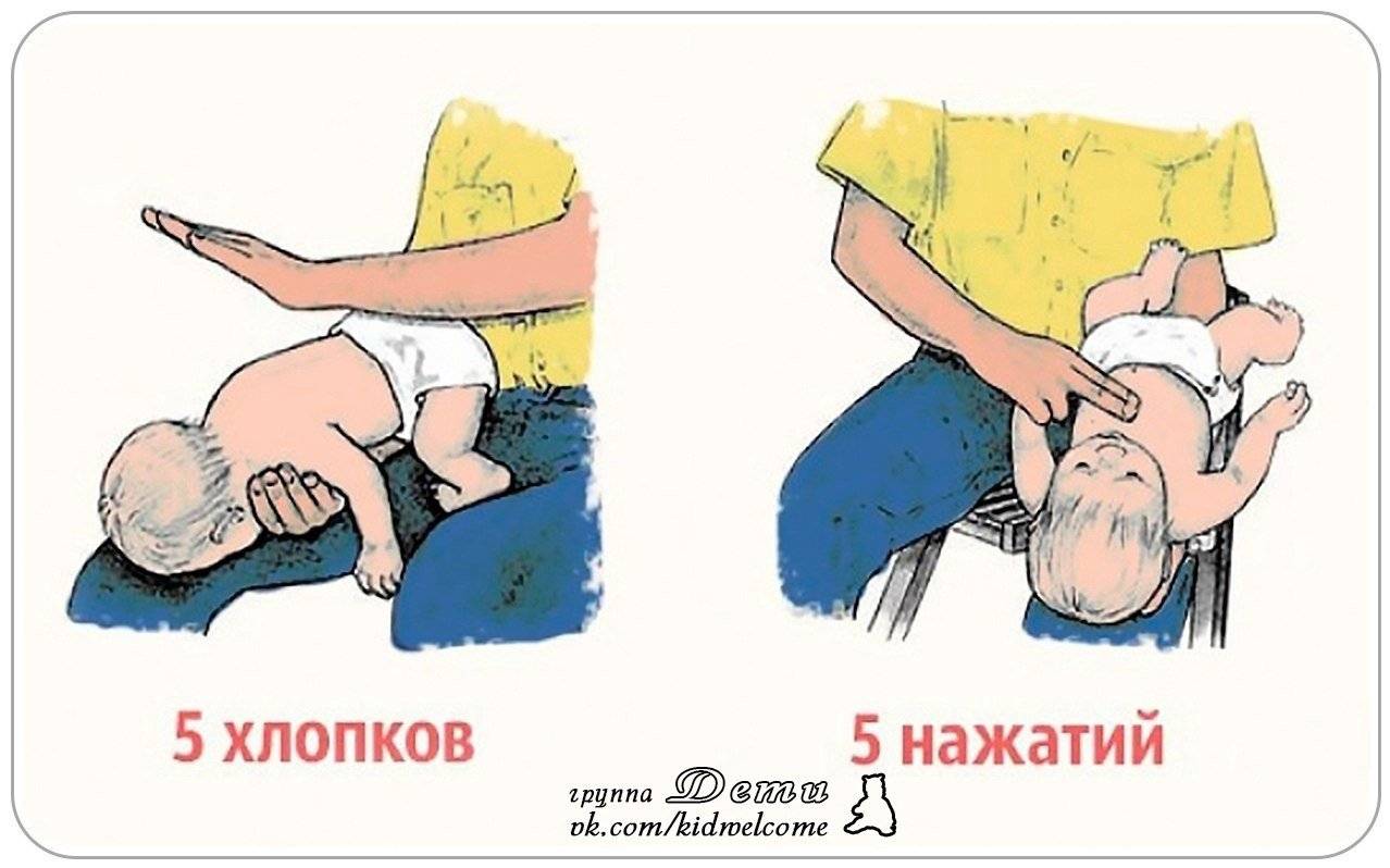 Что делать если новорожденный грудничок подавился молоком и задыхается | complex-clinic.ru