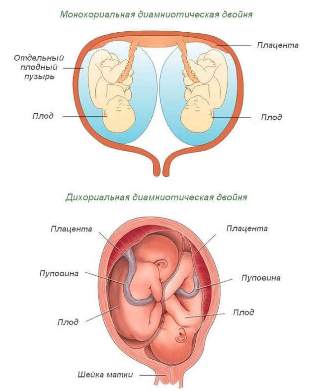 Беременность двойней и тройней по неделям: признаки на ранних сроках, развитие плодов, ощущения мамы