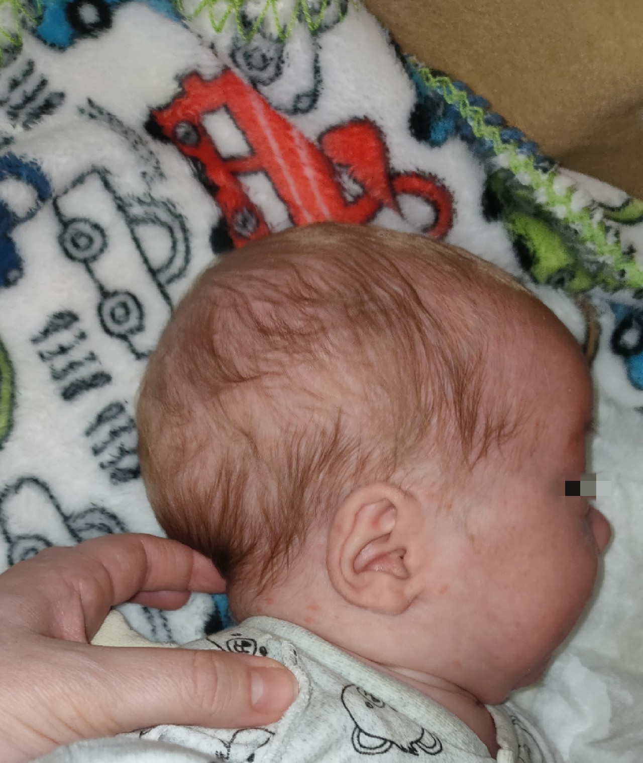 Затылок новорожденного. Выпирающий затылок у младенца. Выпирает затылок у новорожденного. Вытянутый затылок у грудничка.