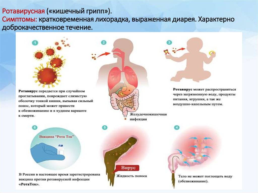 Ротавирусная инфекция: причины, симптомы, лечение