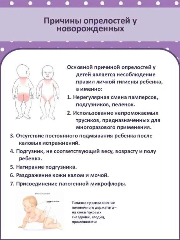 Пеленочный дерматит у малышей: симптомы, причины, лечение и профилактика