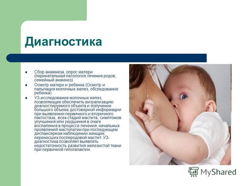 Мастит