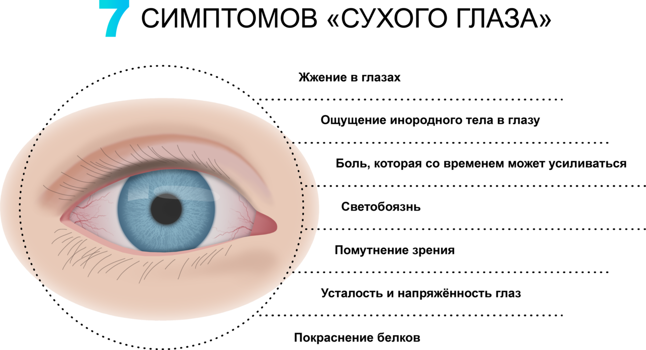 Причины развития синдрома сухого глаза. ССГ (синдром сухого глаза. Синдром сухого глаза профилактика. Причины возникновения синдрома сухого глаза. Боли при повороте глаз