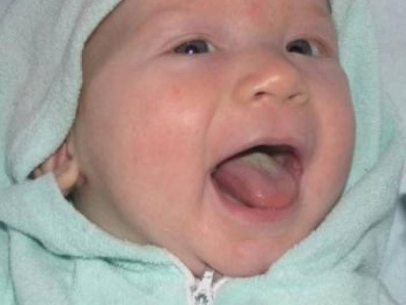 Возможные причины белого налёта на языке и 3 способа его очистки у грудных детей