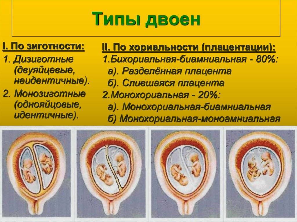 Беременность двойней: первые признаки, развитие беременности по неделям, фото | doctorfm.ru