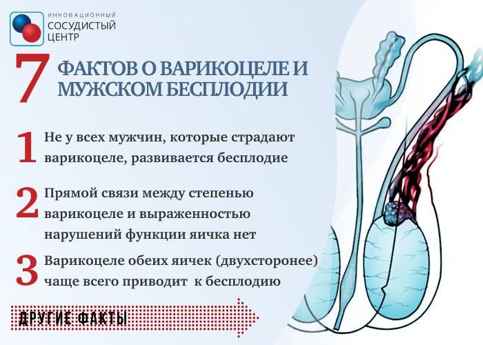 Что такое варикоцеле и почему его нужно лечить
