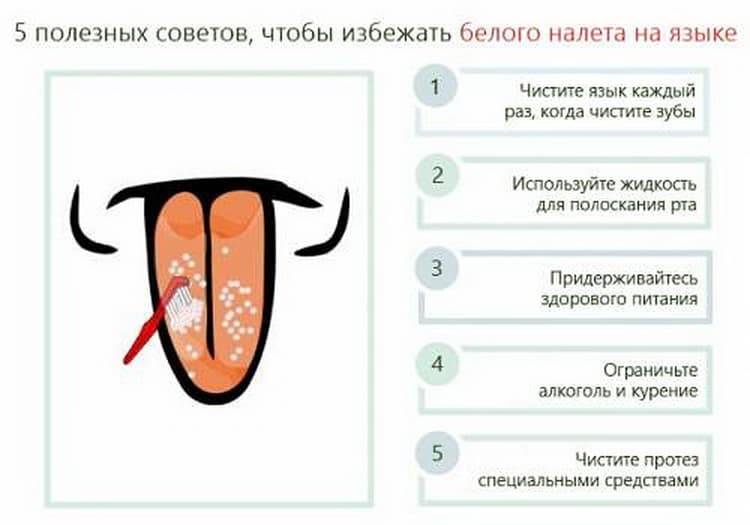Белый налет на языке у грудничка - причины и лечение | merilin-clinic.ru
