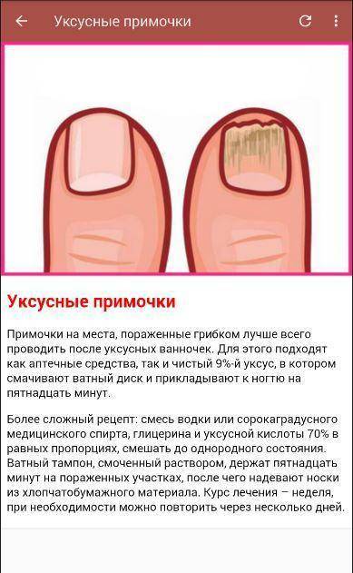 Лак для ногтей для беременных: вреден или нет