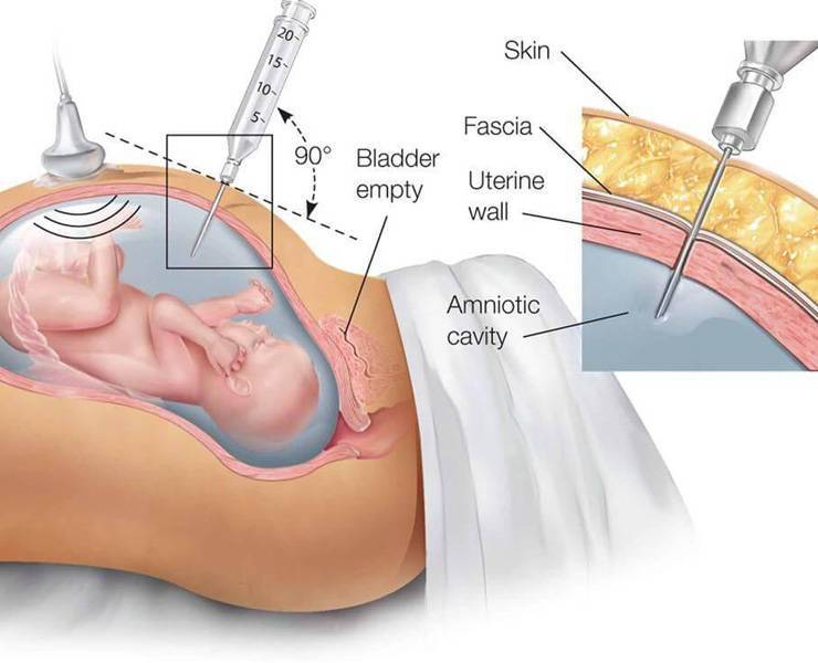 Значение плодных оболочек при беременности