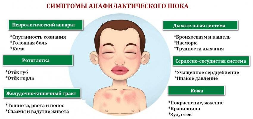 Аллергия на еду: симптомы, причины, диагностика, лечение - статьи медцентра верамед