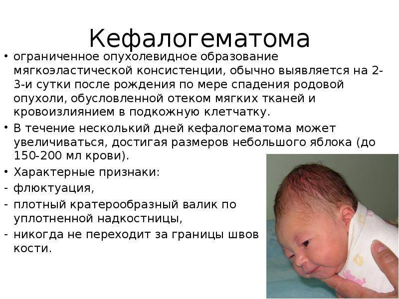 Причины, диагностика и лечение кефалогематомы у новорождённого ребёнка
