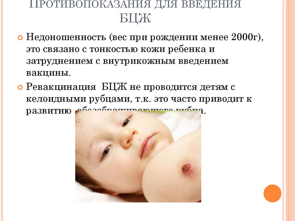 Прививка бцж у новорожденных — реакция на вакцину и противопоказания