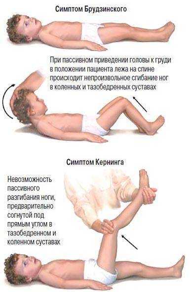 Признаки менингита у детей - стадии, диагностика, гнойный, вирусный