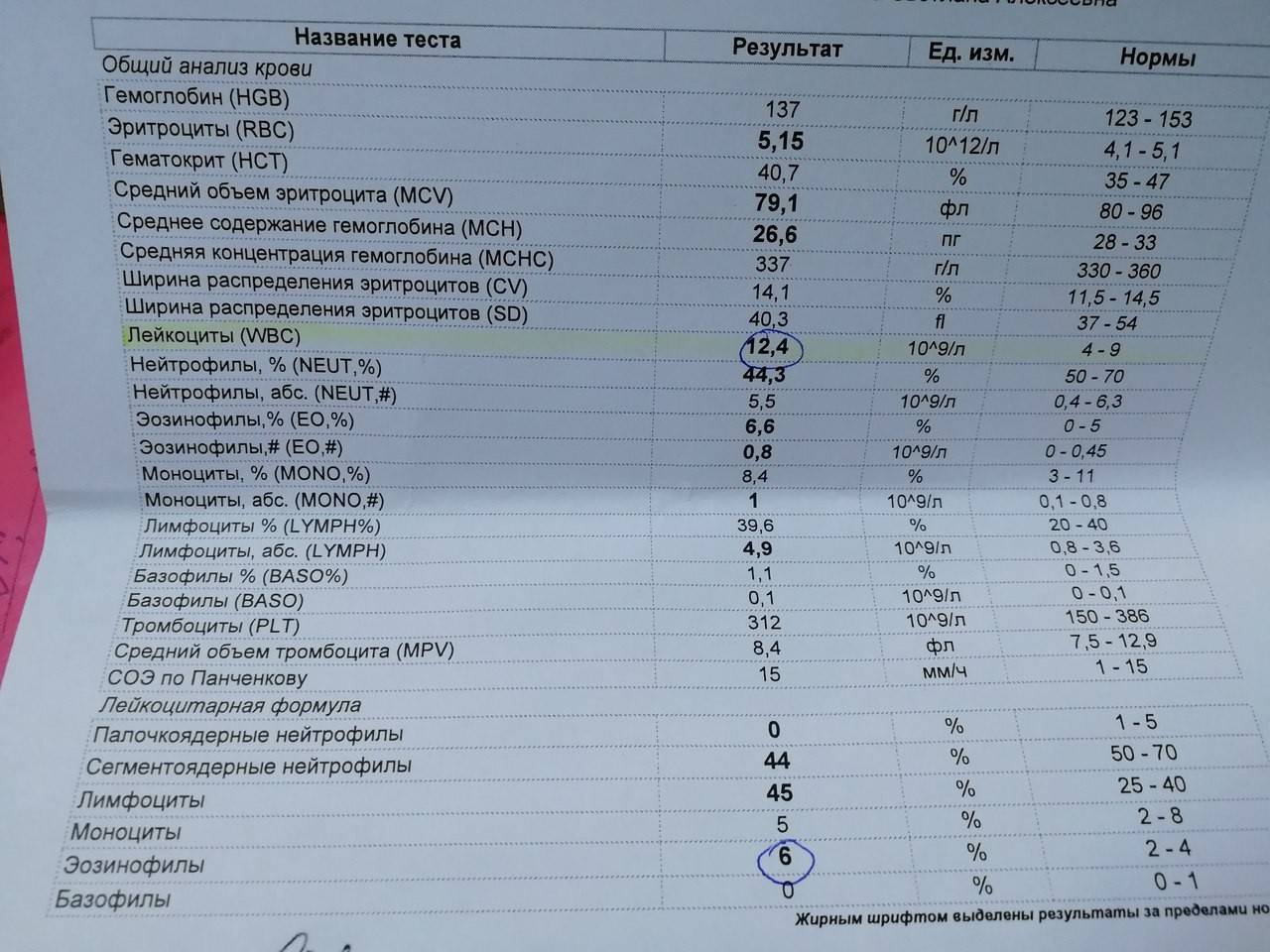 Моноциты повышены у ребенка: о чем это говорит?