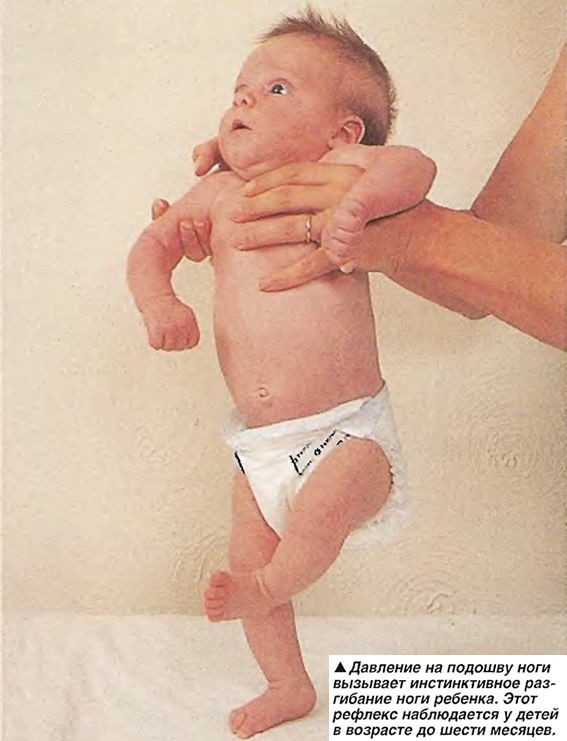 Когда можно ставить на ножки. Рефлекс автоматической походки у новорожденных. Гипертонус конечностей у детей. Гипертонус мышц у грудничков.