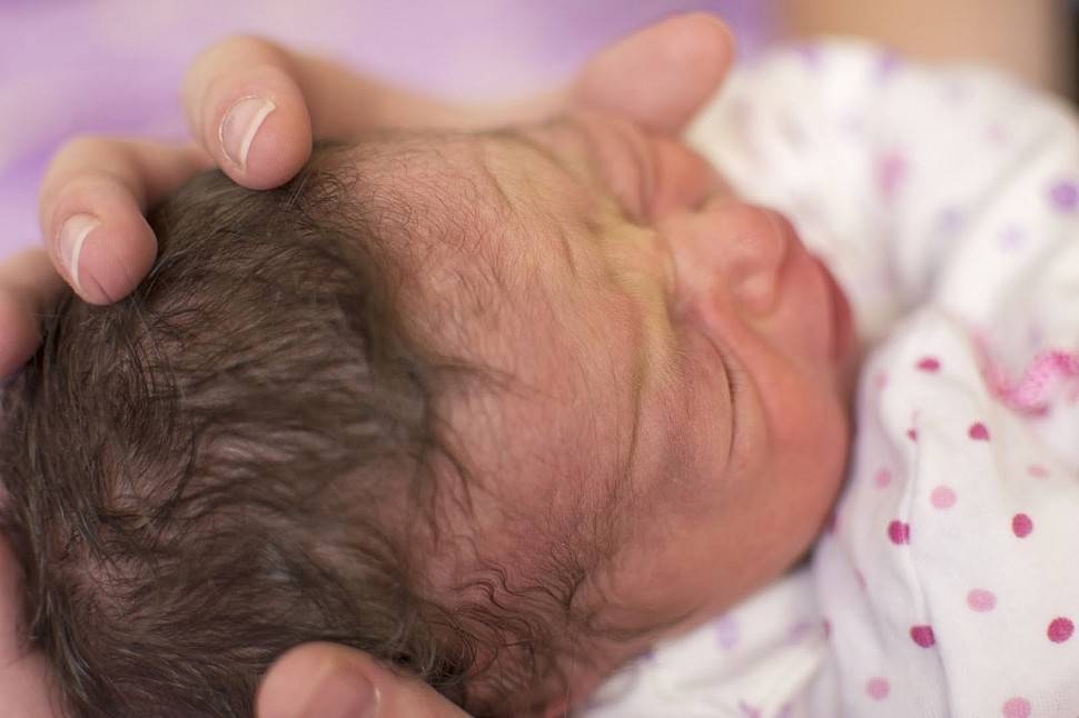 Гематомы при родах на голове у новорожденных