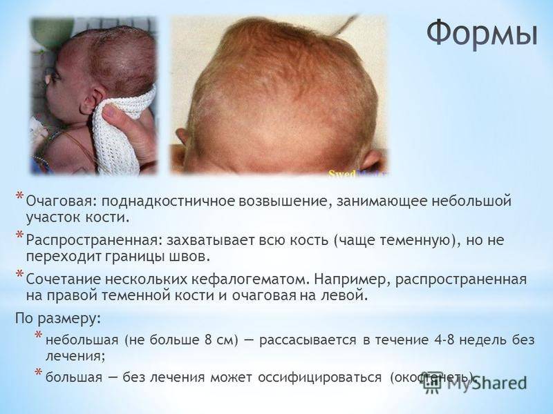 Внутрижелудочковые кровоизлияния у новорожденных, гидроцефалия - государственное учреждение здравоохранения "детская областная больница"