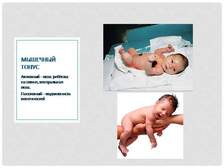Лечение гипертонуса мышц у ребенка в оренбурге