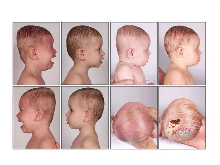 До какого возраста формируется череп у младенца